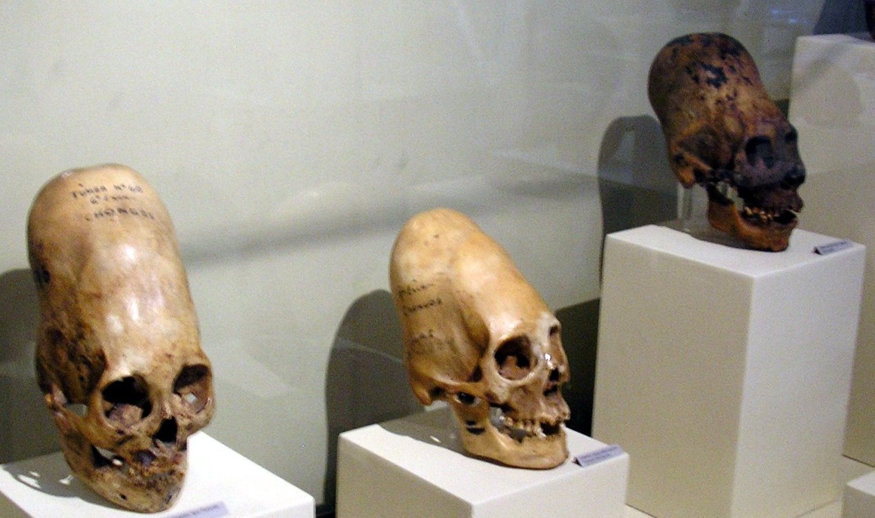 Paracas Skulls