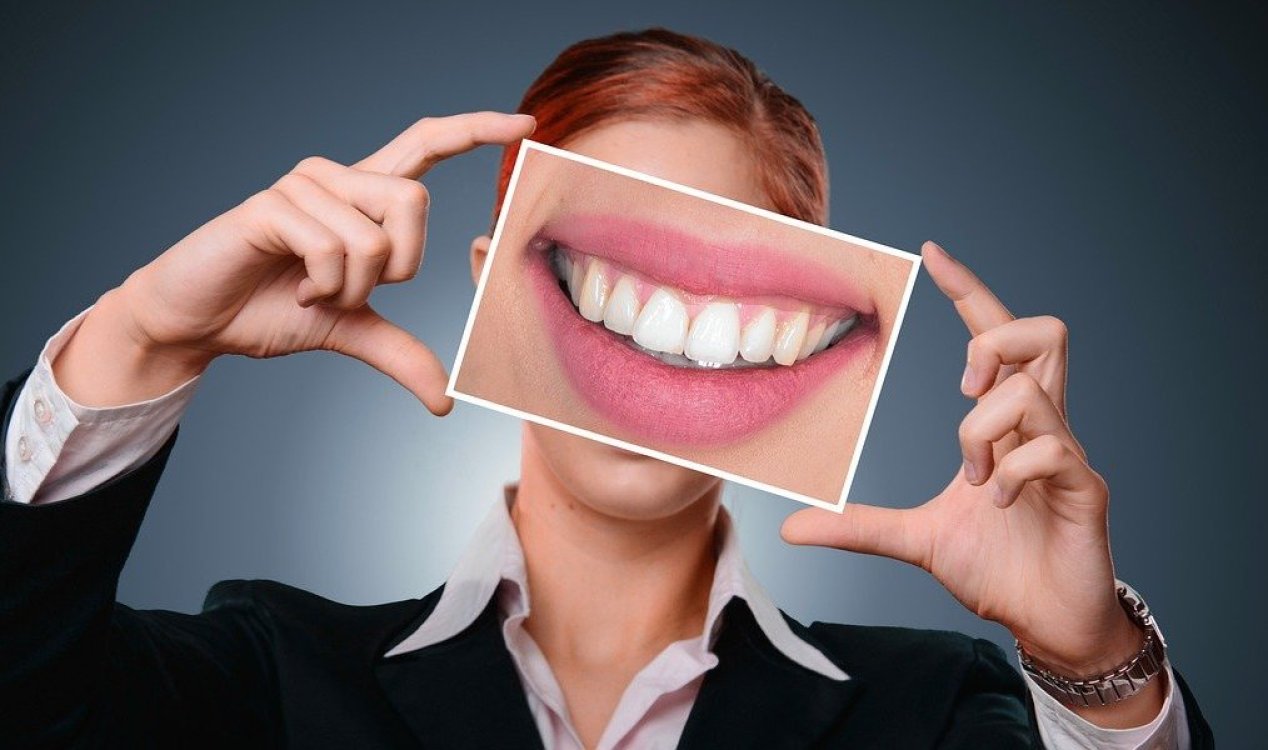 Woman smiling with teeth.